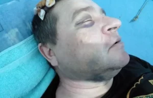 Військкому та сержанту з Полтавщини повідомили про підозру з приводу побиття старшого лейтенанта