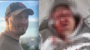 На Полтавщині скоєно напад на громадського діяча та активіста