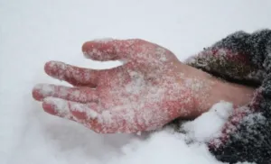 На вулицях Полтави зафіксовано два смертельні випадки через переохолодження