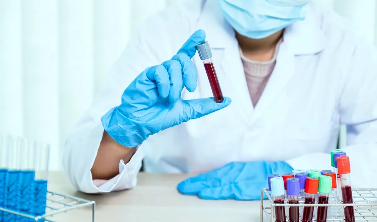 Лабораторні дослідження: що покажуть аналізи Лабораторні дослідження: що покажуть аналізи